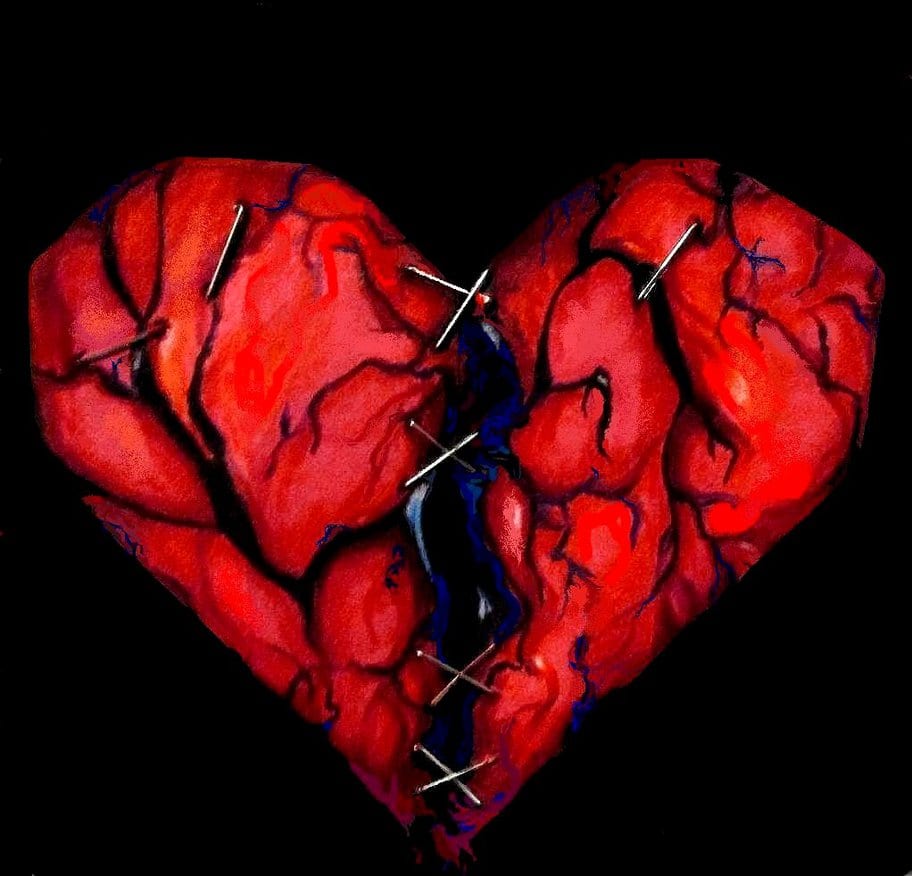 L'amour Qui Fait Mal